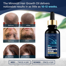 Load image into Gallery viewer, Hair Growth Serum for Men and Women Kit