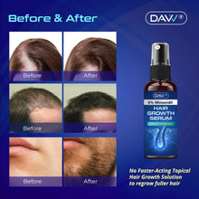 Load image into Gallery viewer, 5% Minoxidil Hair Growth Serum for Men and Women