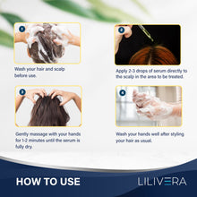 Load image into Gallery viewer, Hair Growth Serum for Men and Women Kit