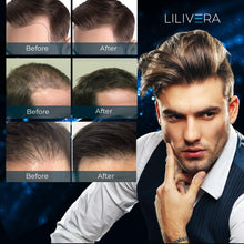 Load image into Gallery viewer, Hair Growth Serum for Men and Women Kit