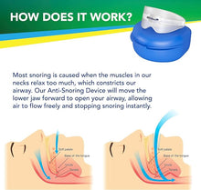 Load image into Gallery viewer, Anti Snore Mouthpiece for Stop Snoring