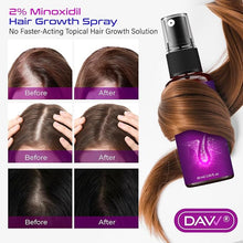 Load image into Gallery viewer, 2% Minoxidil for Women Hair Growth Serum