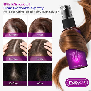 2% Minoxidil for Women Hair Growth Serum